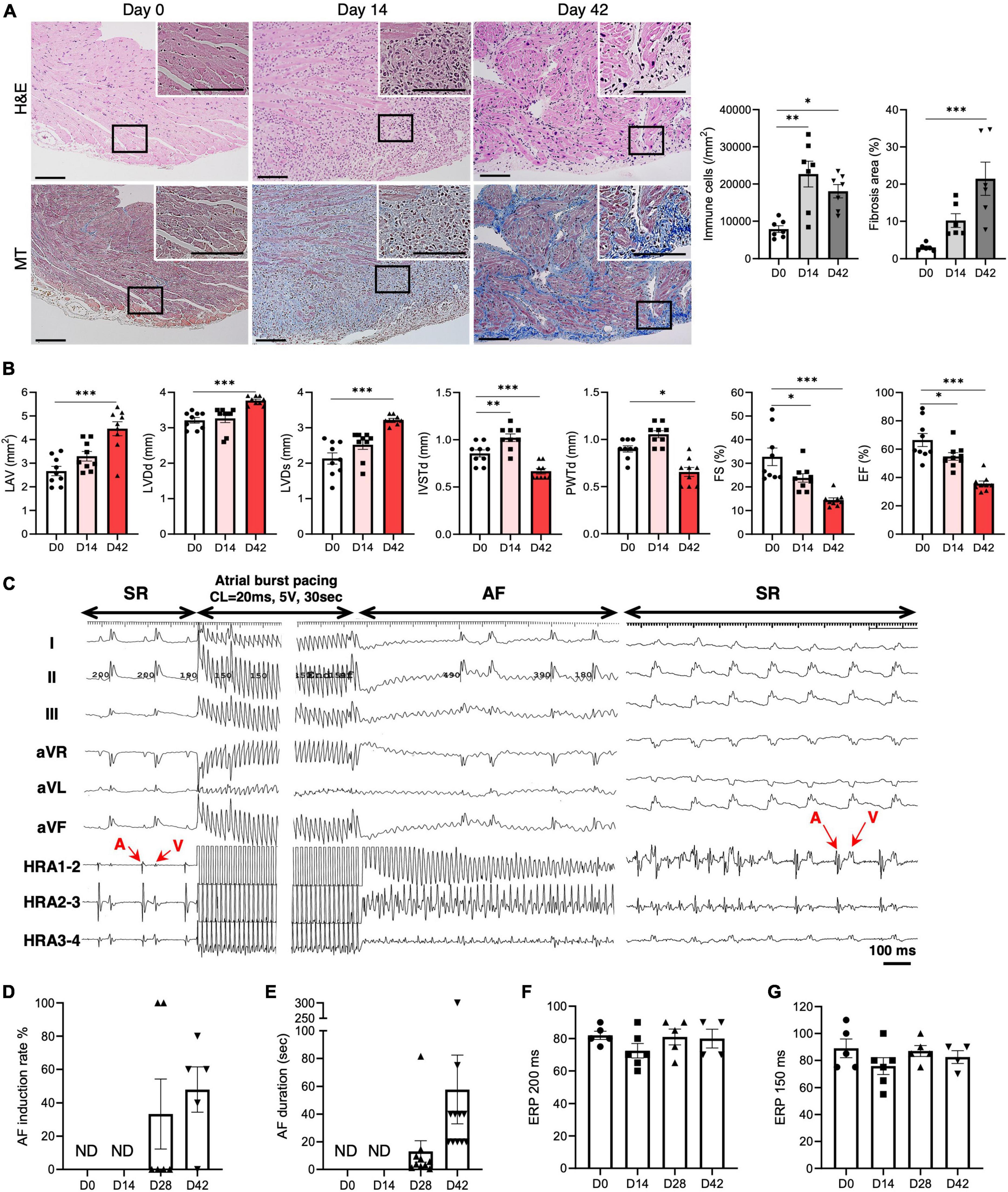 Electrical, structural, and autonomic atrial remodeling underlies atrial fibrillation in inflammatory atrial cardiomyopathy